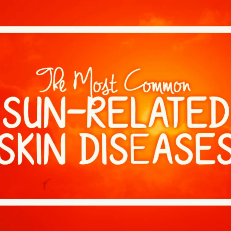 The Most Common Sun-related Skin Diseases