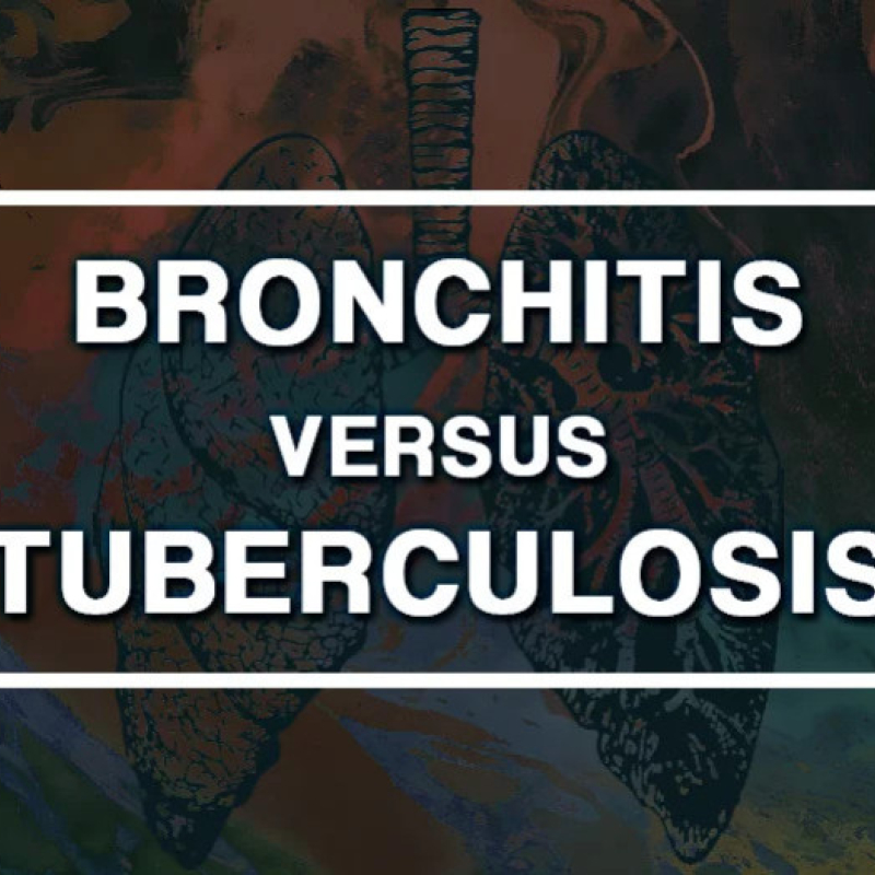 Bronchitis vs Tuberculosis